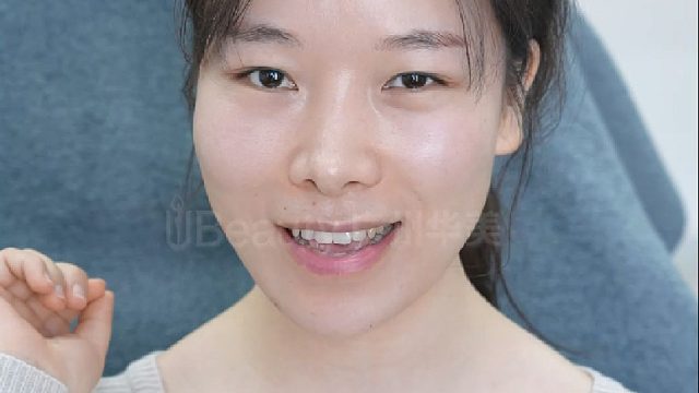 颜值逆袭！面部微微一调，实现轮廓爆改！