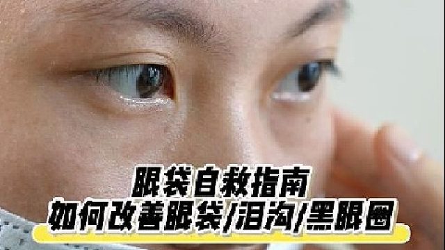 眼袋自救指南！如何改善眼袋泪沟黑眼圈