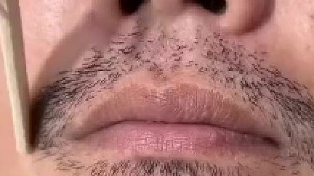 费那事…直接《葵花宝典》，一次性解决