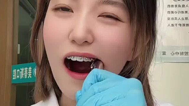 女牙科医生自己拔智齿，全程面无表情云淡风轻_“一颗智齿而已，下次再拔两颗_