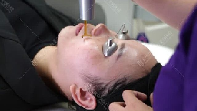 不留一斑！是我要的素颜自由