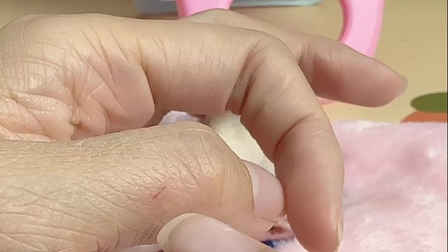 虽然抓得不疼，但是在手上盘的时间还是挺长的，不想让自己手不舒服，咱还是老老实实剪指甲吧