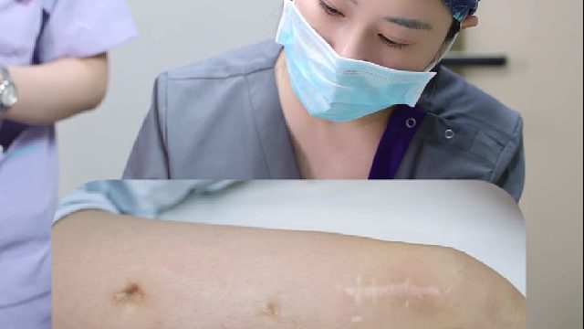 小女孩摔伤大腿手术后留下凹陷疤痕！