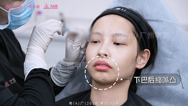 微调即巅峰！呆萌小土妞逆袭灵气小仙女