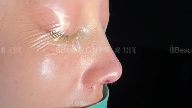 从“扁平塌”到“精致翘”，侧颜轮廓瞬间“立起来”