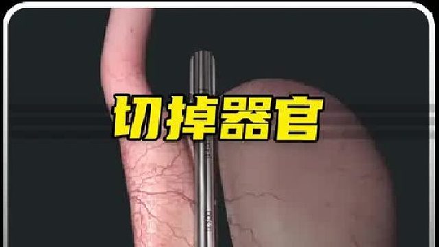 你可能不知道，你的身体有多爱你，切掉这五种器官人都还能存活