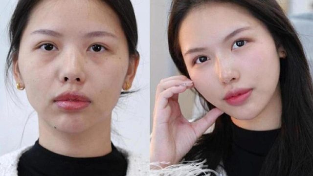 OMG 5支！我的脸从扁平疲惫到骨相立体