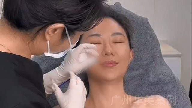 广州华美U美肌因焕活，轻轻松松搞掂真性纹