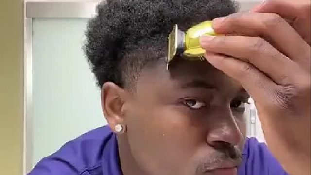 小伙拿剃刀刮额头，没想到额头居然有一层头发，网友瞬间白了很多