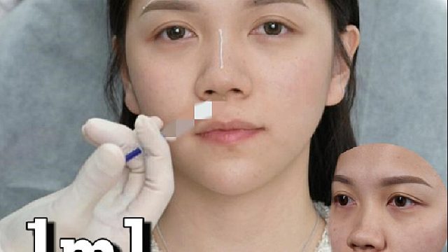 不do刀，如何爆改矮塌鼻？打造自然小翘鼻