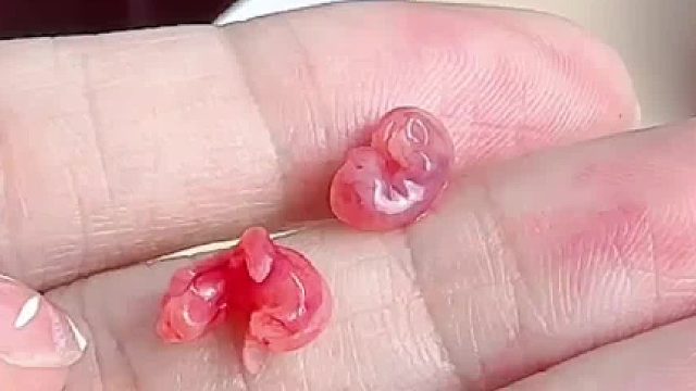 第一次当妈妈的小家伙，在手上玩着玩着把孩子生我手上就跑了