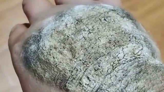 铁砂掌练成，工地搬砖不在话下！