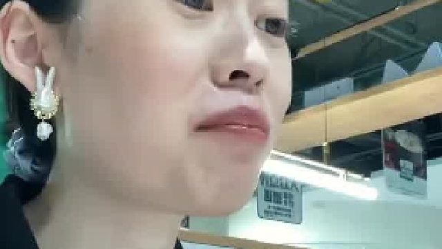 女子戴牙套矫正好龅牙，结果嘴还没意识到老不自觉撅起。