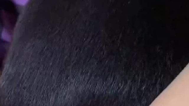 为什么会秃顶呢