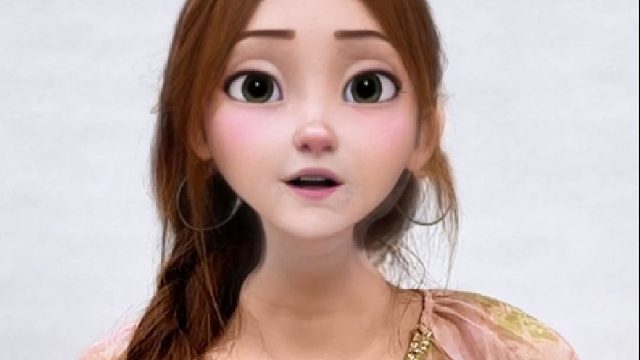 假体隆胸术后17天，整体形态非常满意！