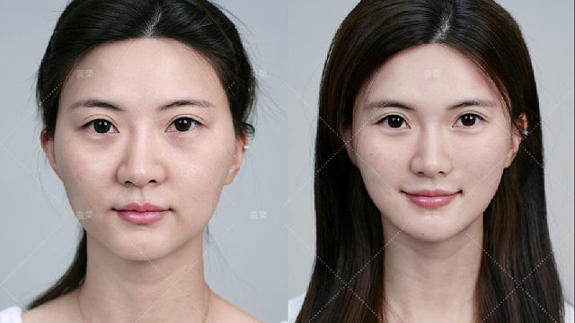 颧骨高菱形脸｜靠一招重回颜值巅峰