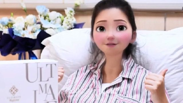 星钻术后第二天：手感柔软，体验感非常好！