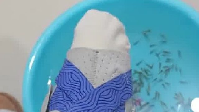 骨折后 封印了两个月的石膏脚，做鱼疗泡脚后…，这威力有点大