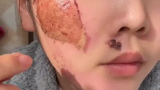 原来身体自愈力这么神奇，撕开结痂看到粉嫩的新皮肤