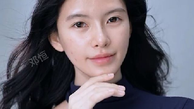 告别扁平脸！骨相美学拯救面中凹陷