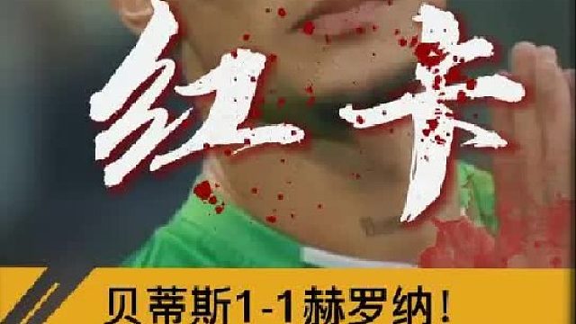 “安东尼直红，贝蒂斯1比1赫罗纳”