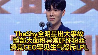 TheShy全明星出大事故！臉部大面積異常嚇壞粉絲，騰競(jìng)CEO罕見生氣怒斥LPL