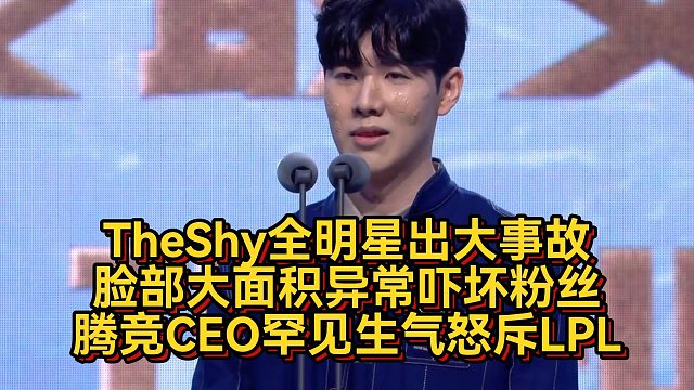 TheShy全明星出大事故！脸部大面积异常吓坏粉丝，腾竞CEO罕见生气怒斥LPL