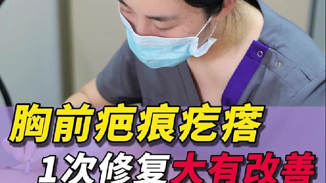 胸前疤痕疙瘩，1次修复大有改善！