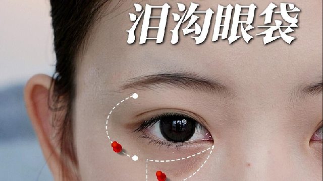 真相了！2步就能改善黑眼圈泪沟眼袋