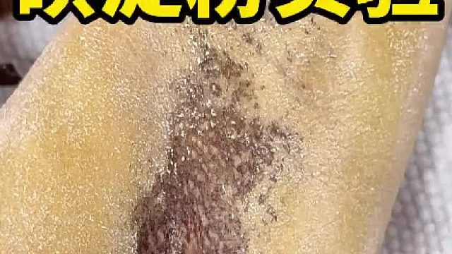 碘淀粉实验 怎么确定腋臭范围