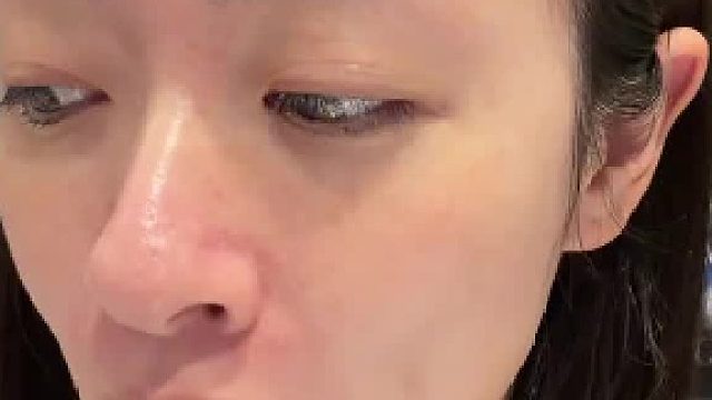 一场由玻尿酸引发的人血馒头