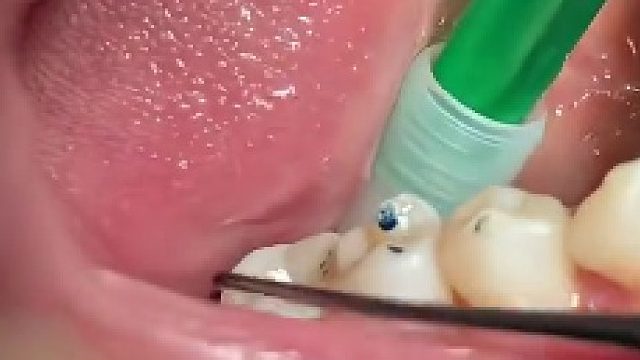 感觉牙缝里的东西还能炒盘菜