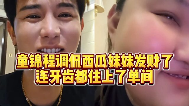 【童锦程】童锦程调侃西瓜妹妹发财了，连牙齿都住上了单间