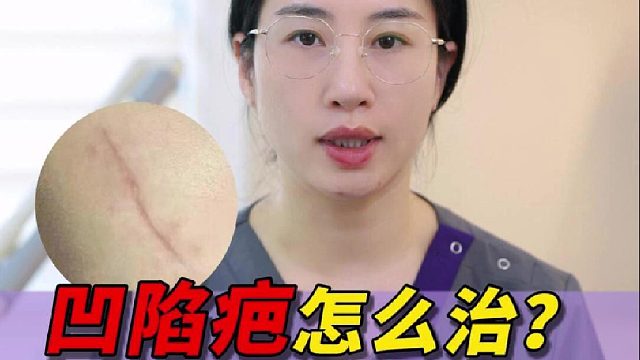 到处问凹陷疤怎么治？一条视频给你讲明白