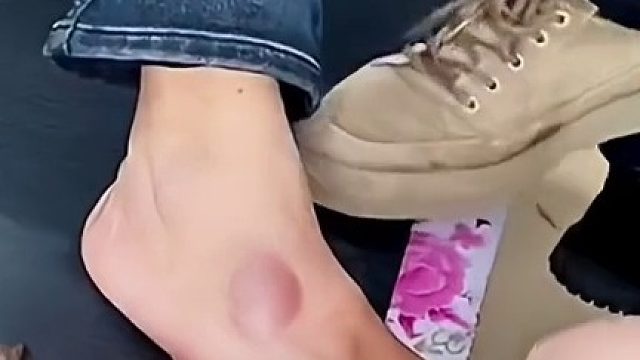 好家伙，里面的血管都爆了