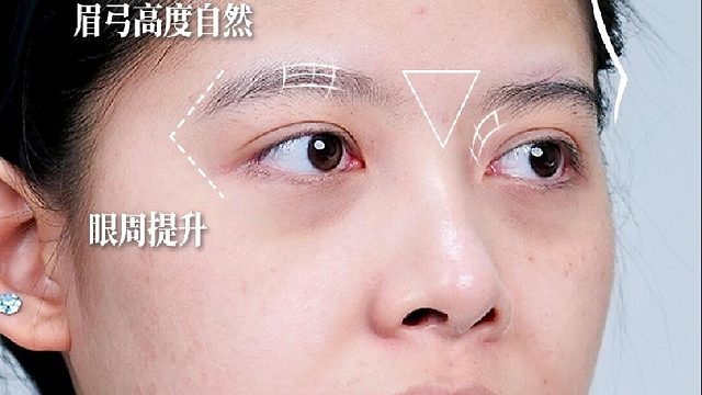 眉弓低平双眼无神？3步眼周回春变好看