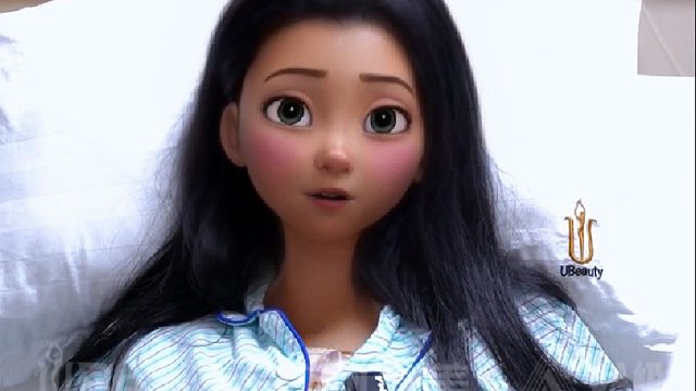 16H舒柔丰胸术后第二天能自由活动，客户很满意！