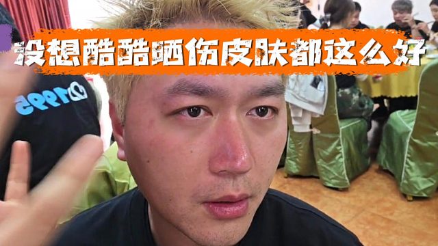 酷酷容貌危机，直播咨询晒伤怎么搞
