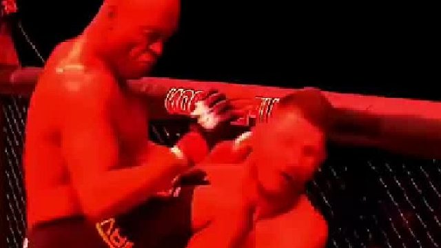 迈克尔·比斯平的护齿脱落