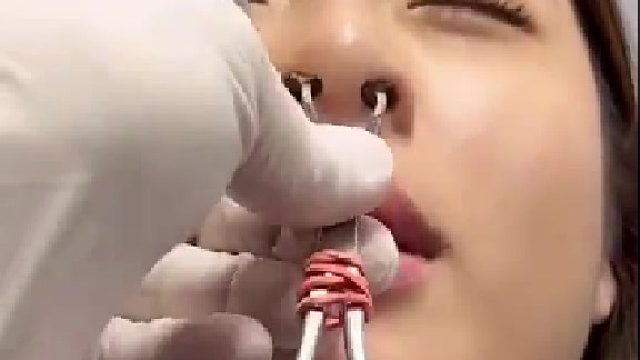 疼的眼泪掉下来，哈哈