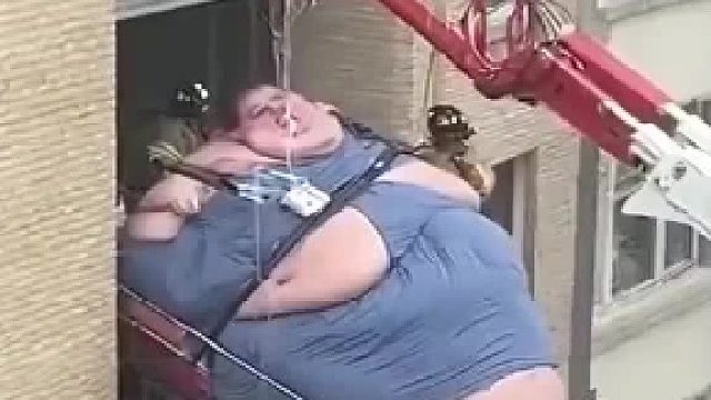 拯救超500斤大胖子 ​​​