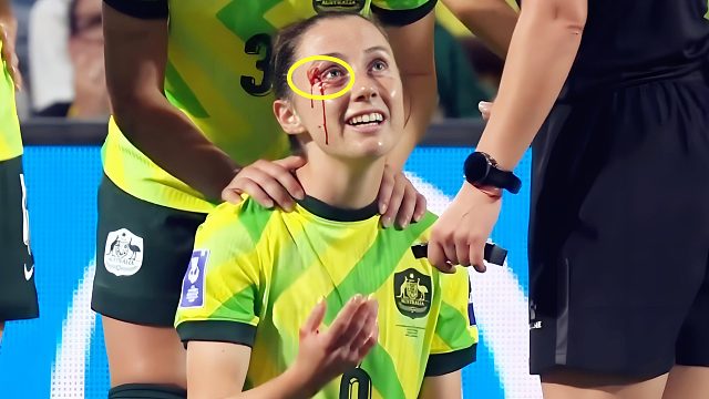 真狠！朝鲜女足肘击澳洲球员吃黄牌，故意推倒门将被警告