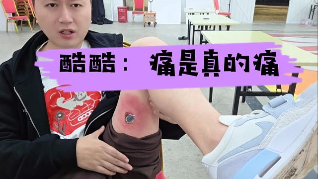 酷酷展示创面伤口，看起来是真疼不骗人