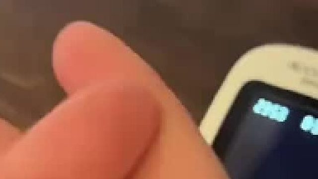 女子扎破手测血糖，不料指尖血竟喷了出来。