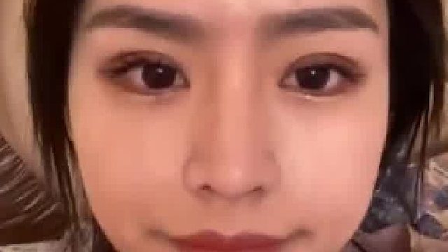 女子对脸部进行13次整容，总共花费140万元