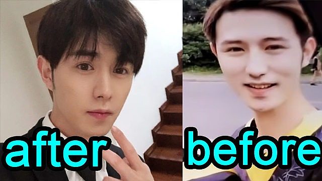 童锦程大方自曝，除了脸其他都没动过