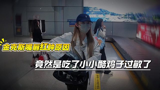 金克斯嘴唇红肿原因，竟然是吃了小小酷鸡子过敏了