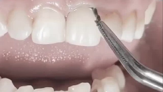 吓死人了