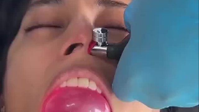有什么作用