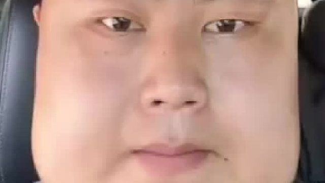 33岁男子吃槟榔18年，口腔溃烂张不开连一根筷子都难以塞入